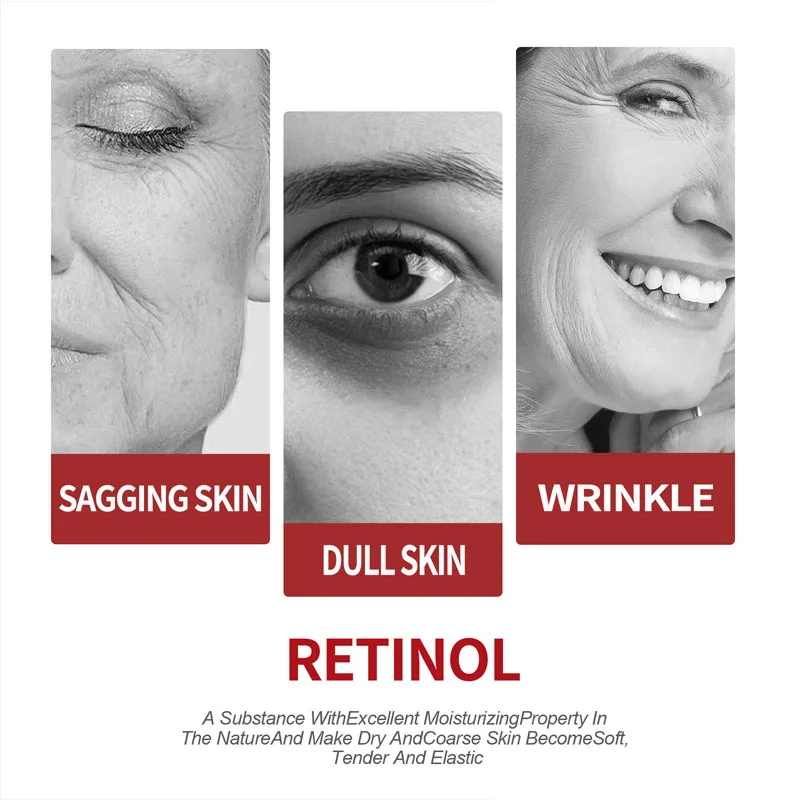 Retinol Cream  Moisturizing Sk - Milk Thistle Silymarin review and price